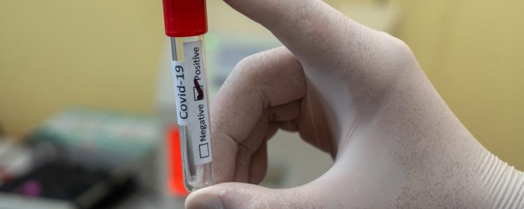 COVID PCR test analysis